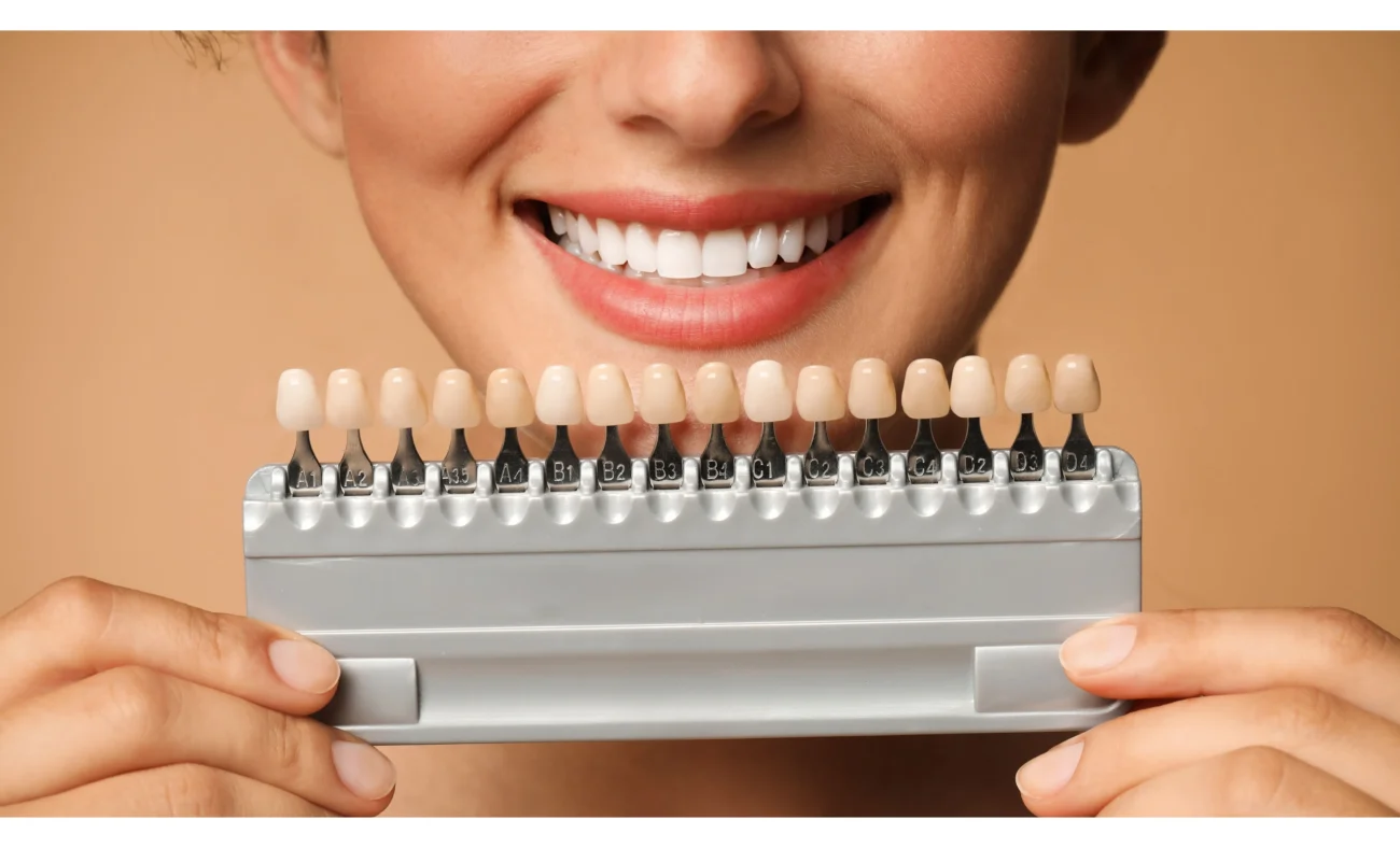 Dental Crowns vs Veneers NZ: Woman Holding Teeth Colour Samples to Mouth